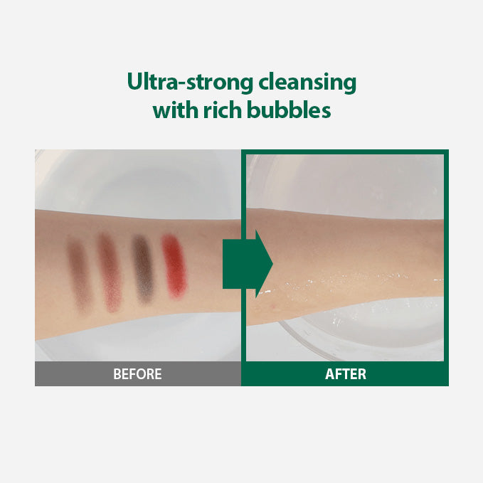 Pore Intensive Care Set