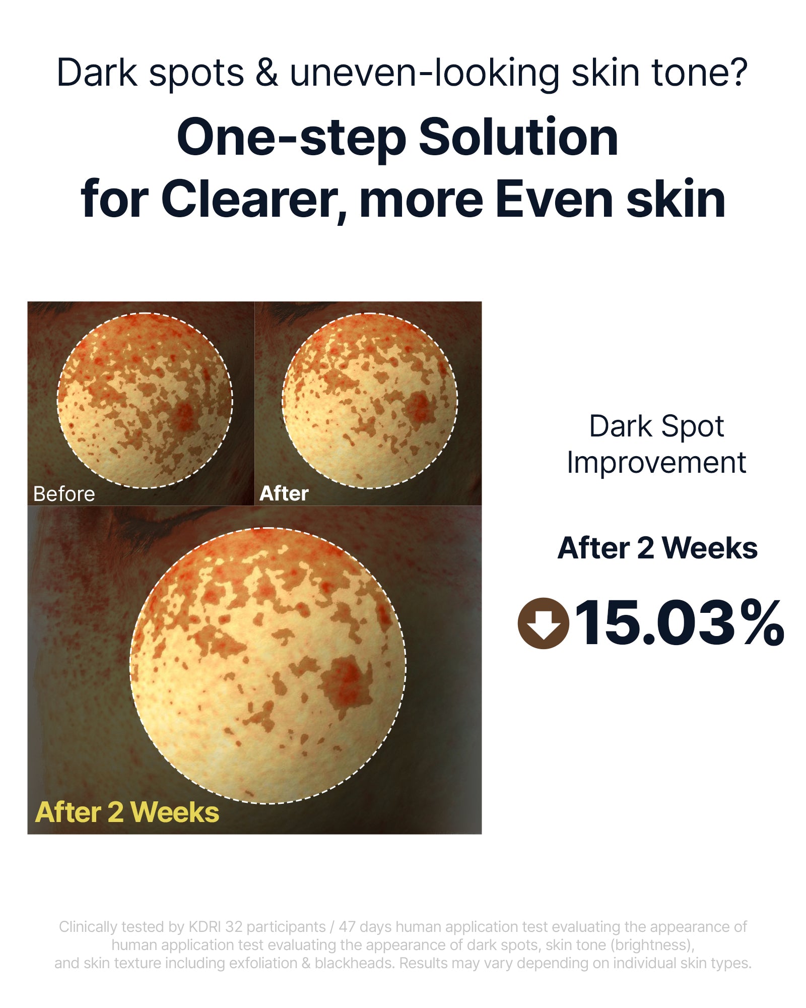 Kojic Acid Niacinamide Rice Peel Shot