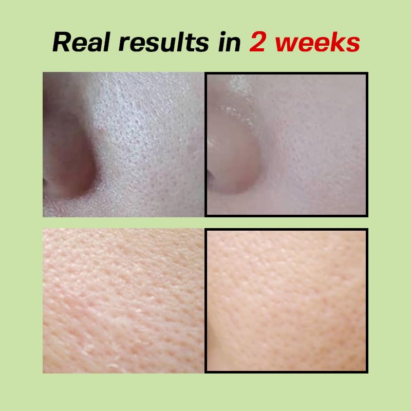Green Tomato Pore Lifting Ampoule+