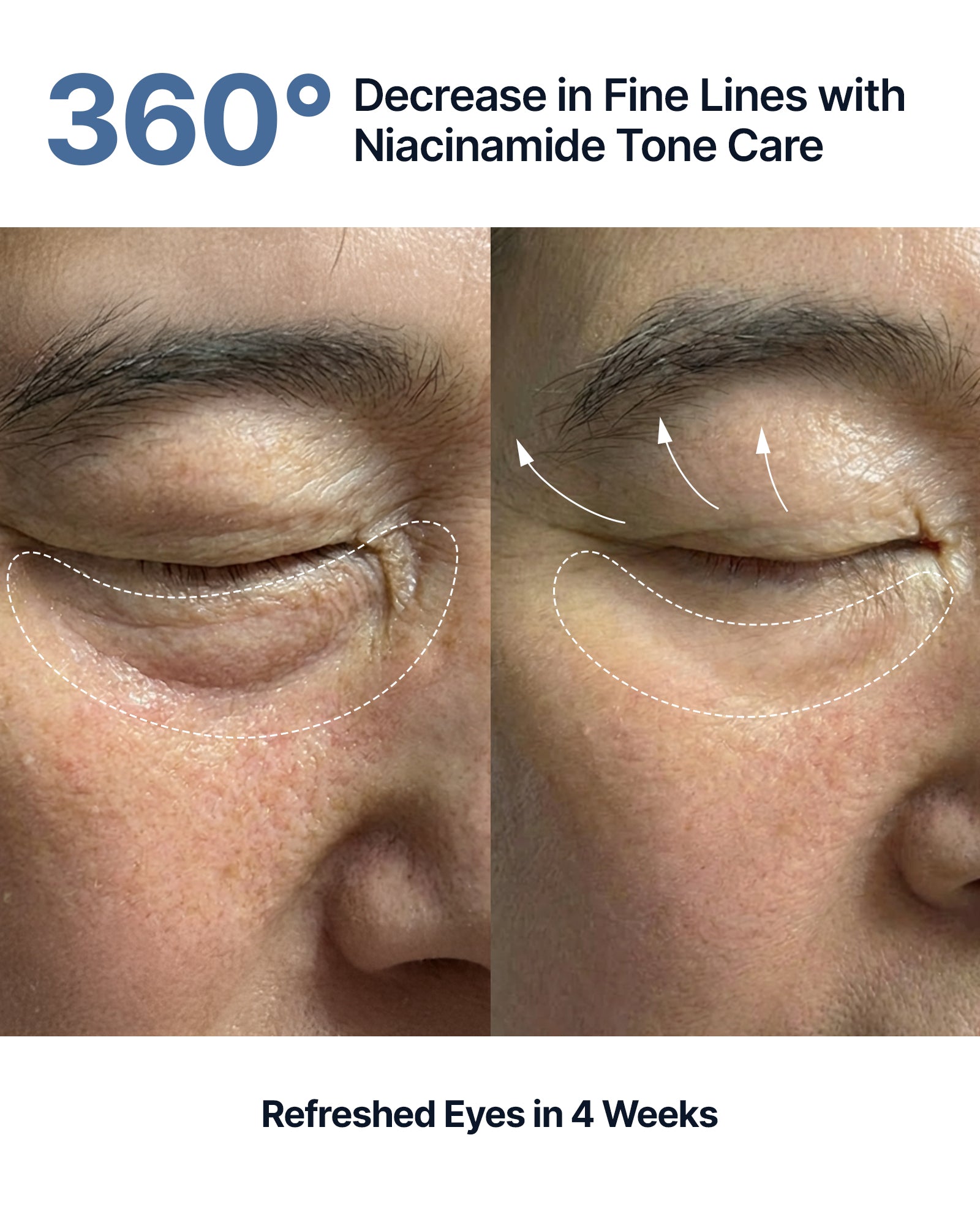 Silk Peptide EGF Intensive Eye Cream