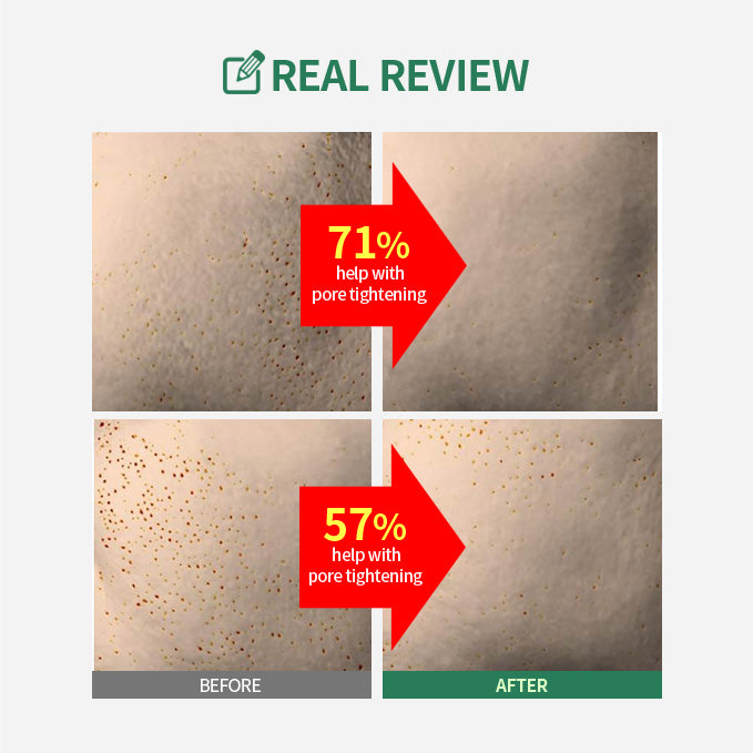 Pore Intensive Care Set