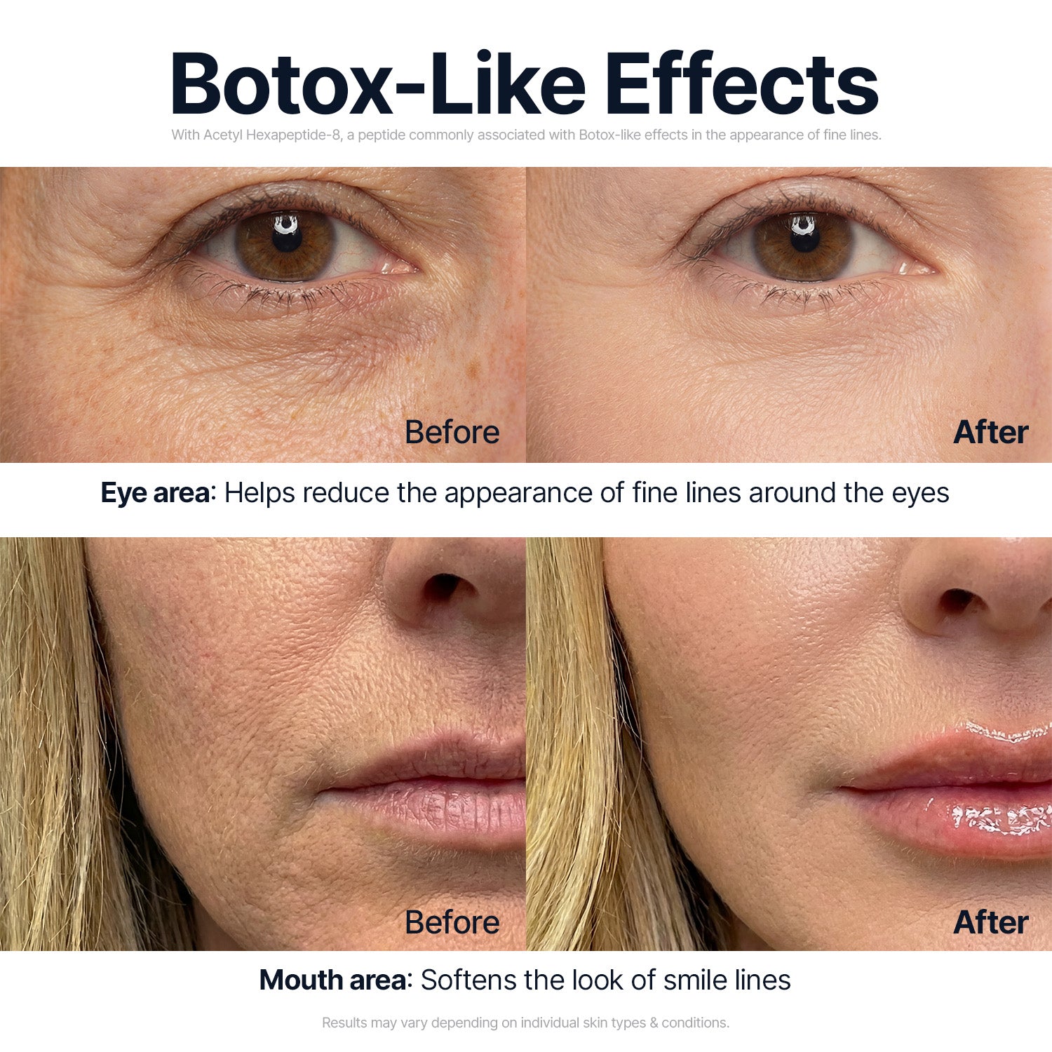 Silk Peptide Lifting Set