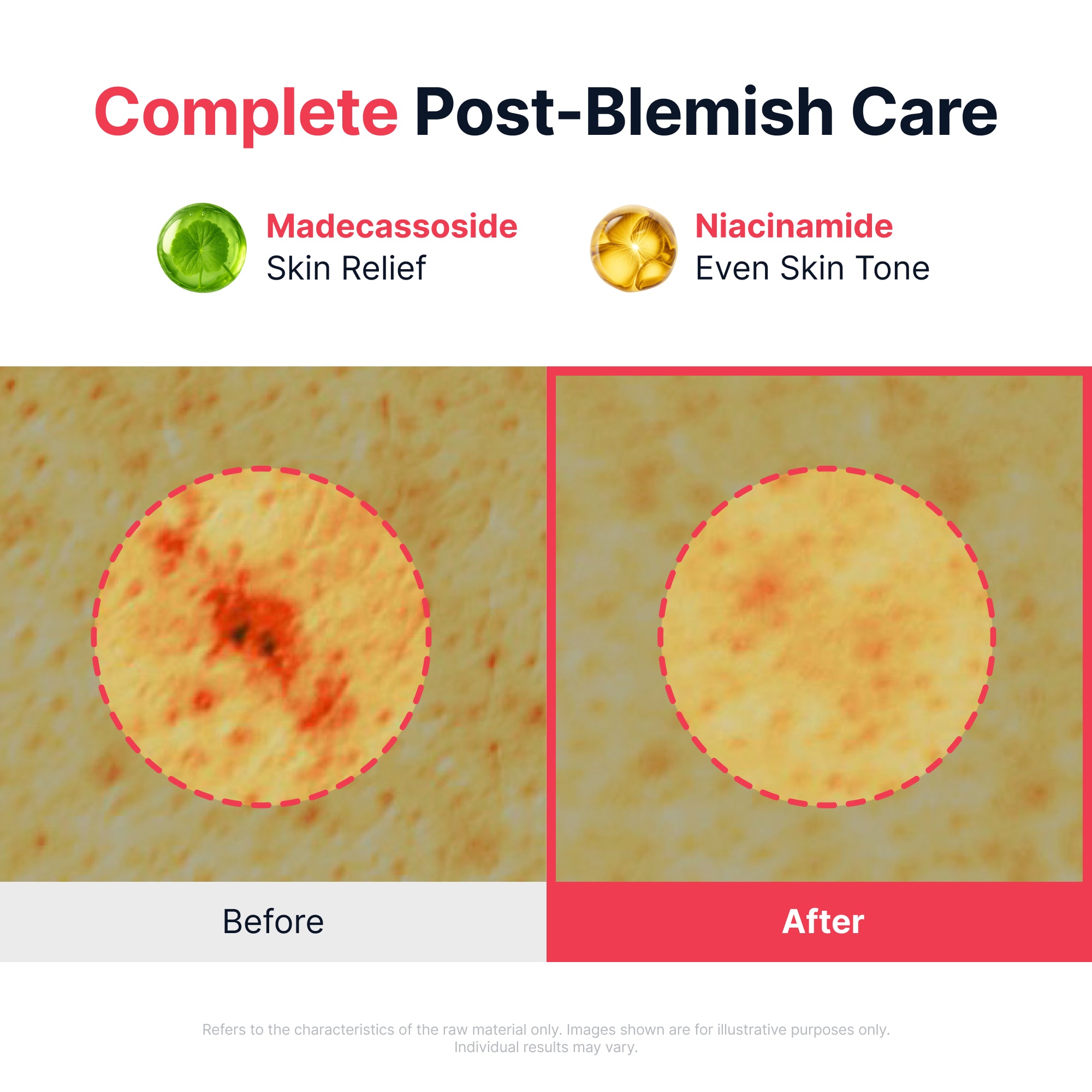 Red Heartleaf BHA-Lino Relief Ampoule