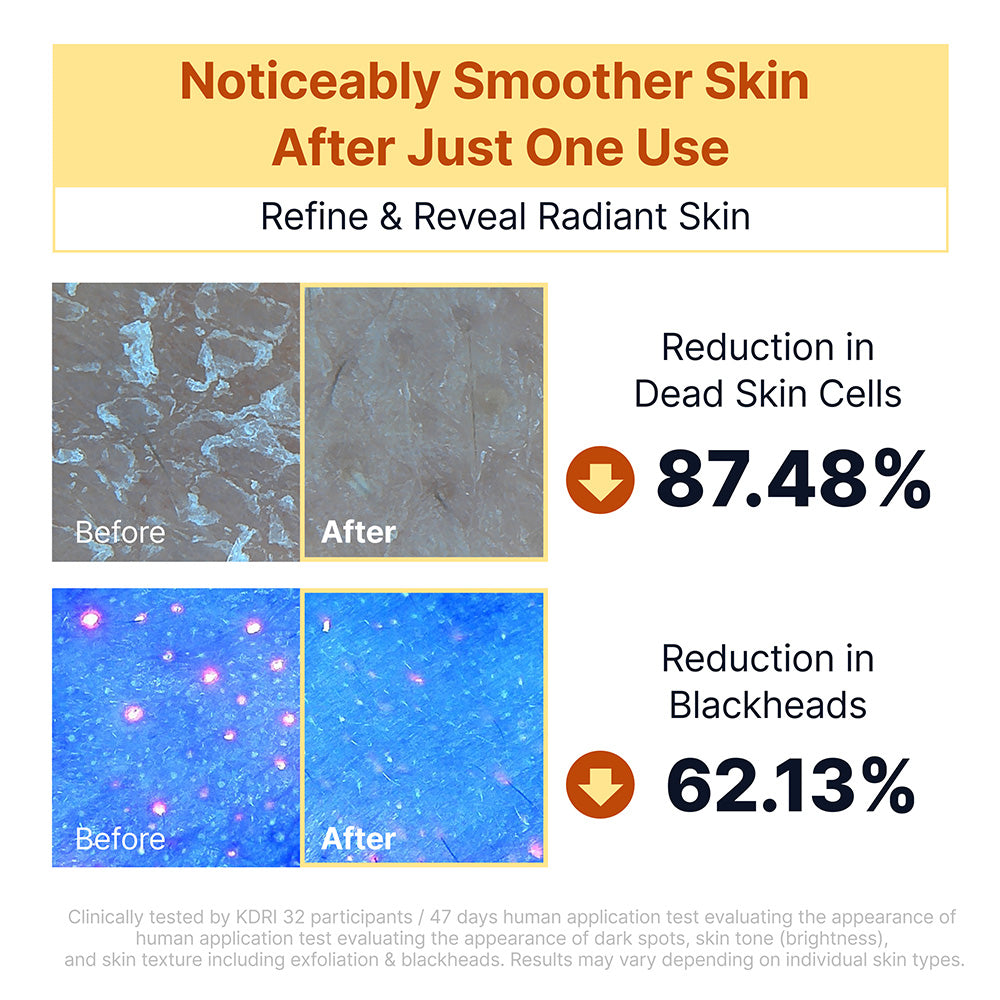 Kojic Acid Niacinamide Rice Peel Shot