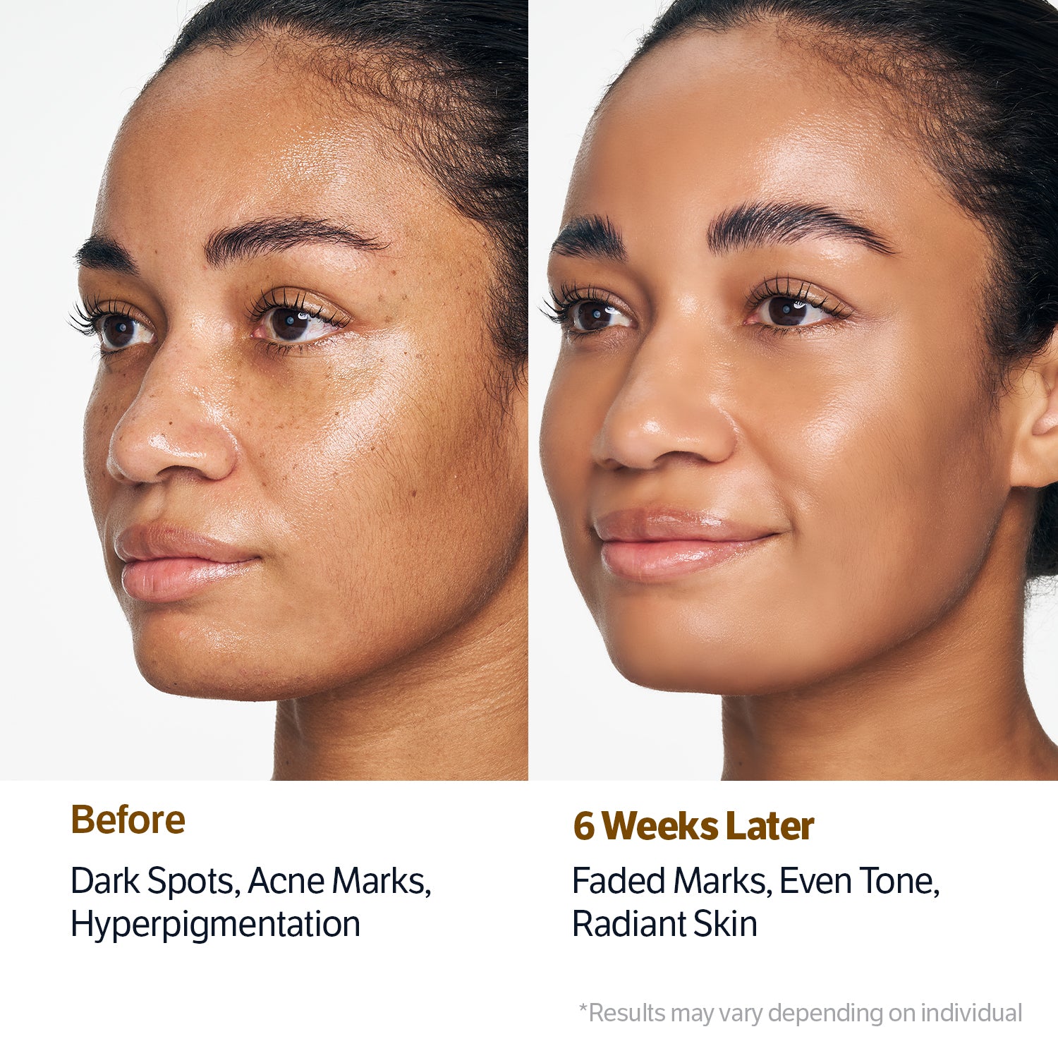 Glowing & Brightening Set