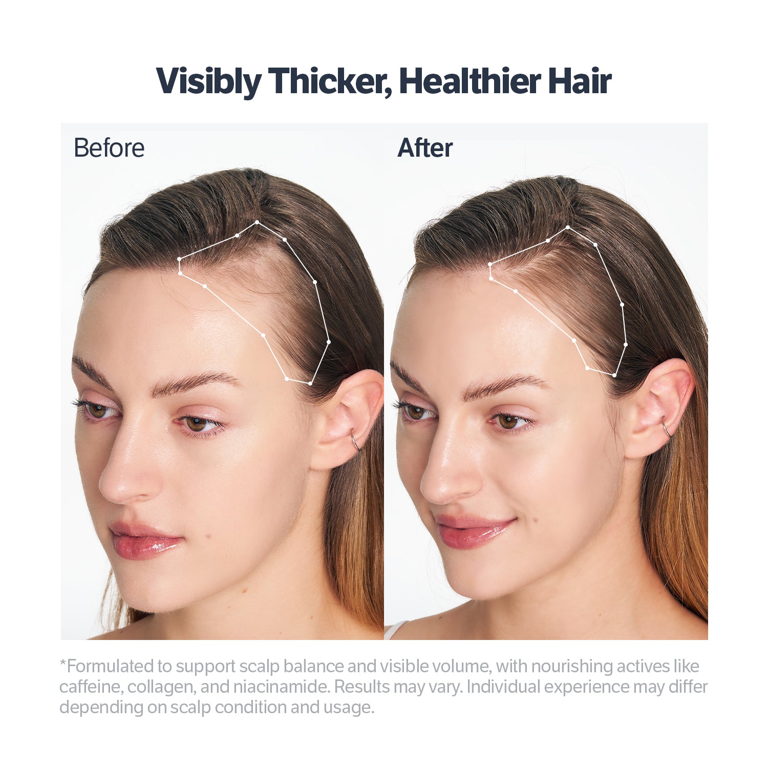 Deep Collagen Retinol Advanced Scalp Treatment Serum