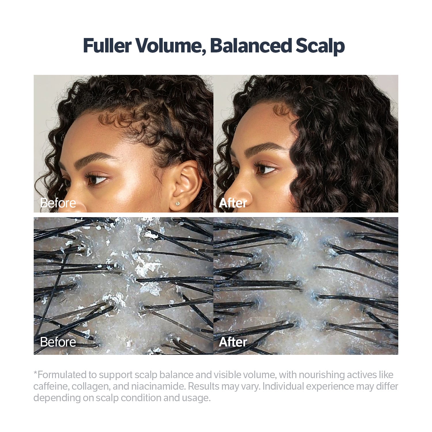 Deep Collagen Retinol Advanced Scalp Treatment Serum
