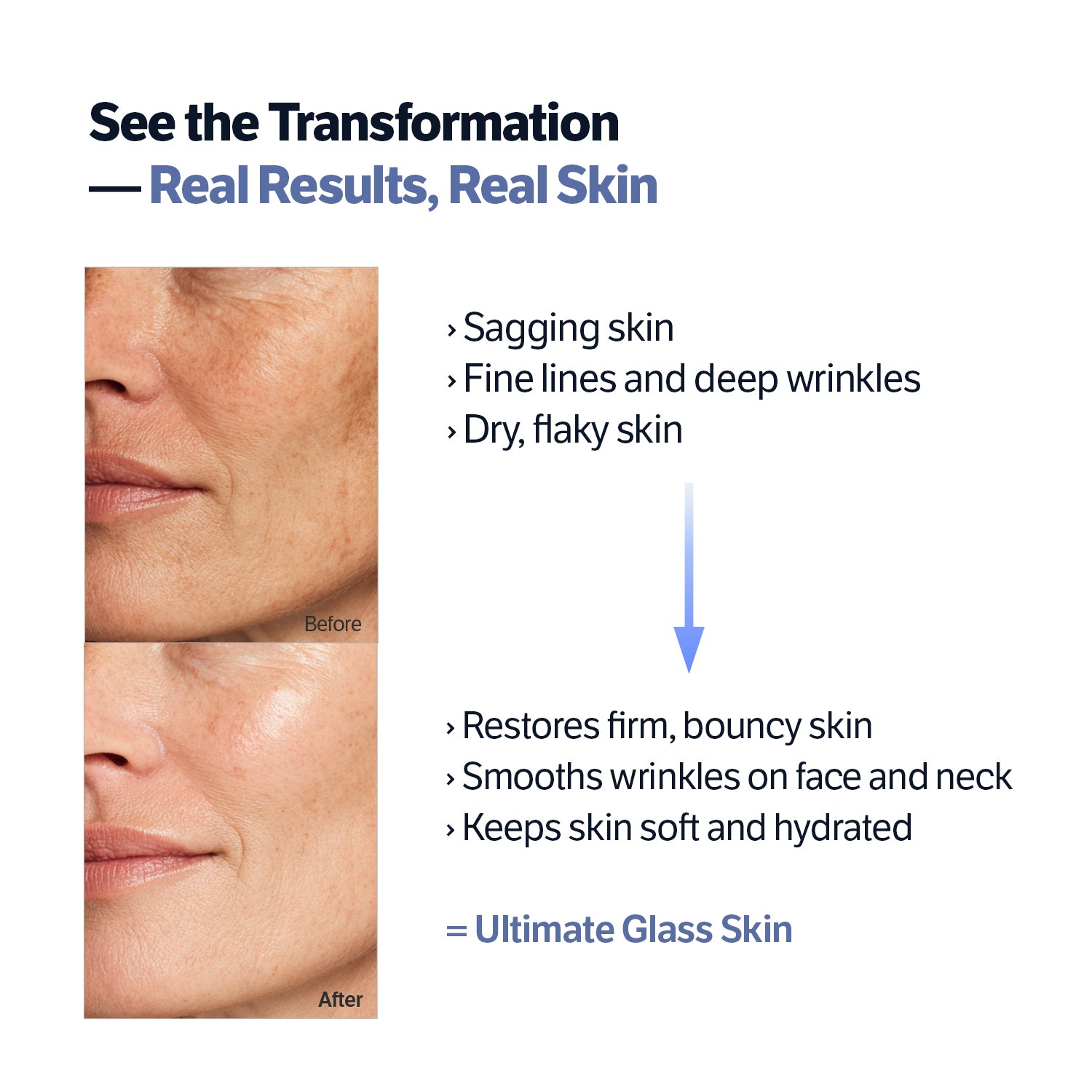 Sungboon Collagen Essentials Set