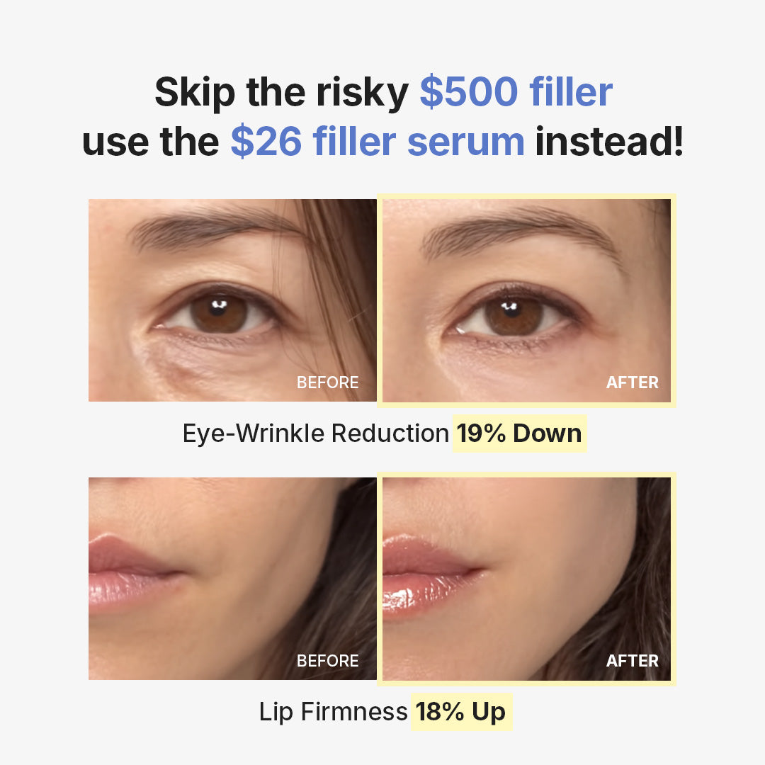 Amazon Exclusive] Deep Collagen wrinkle filler Serum