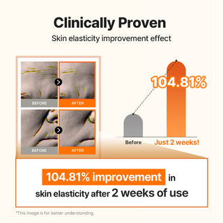 Collagen Boosting White Spicule Cream