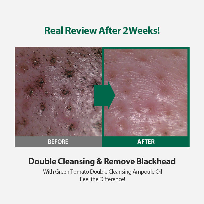 Pore Intensive Care Set