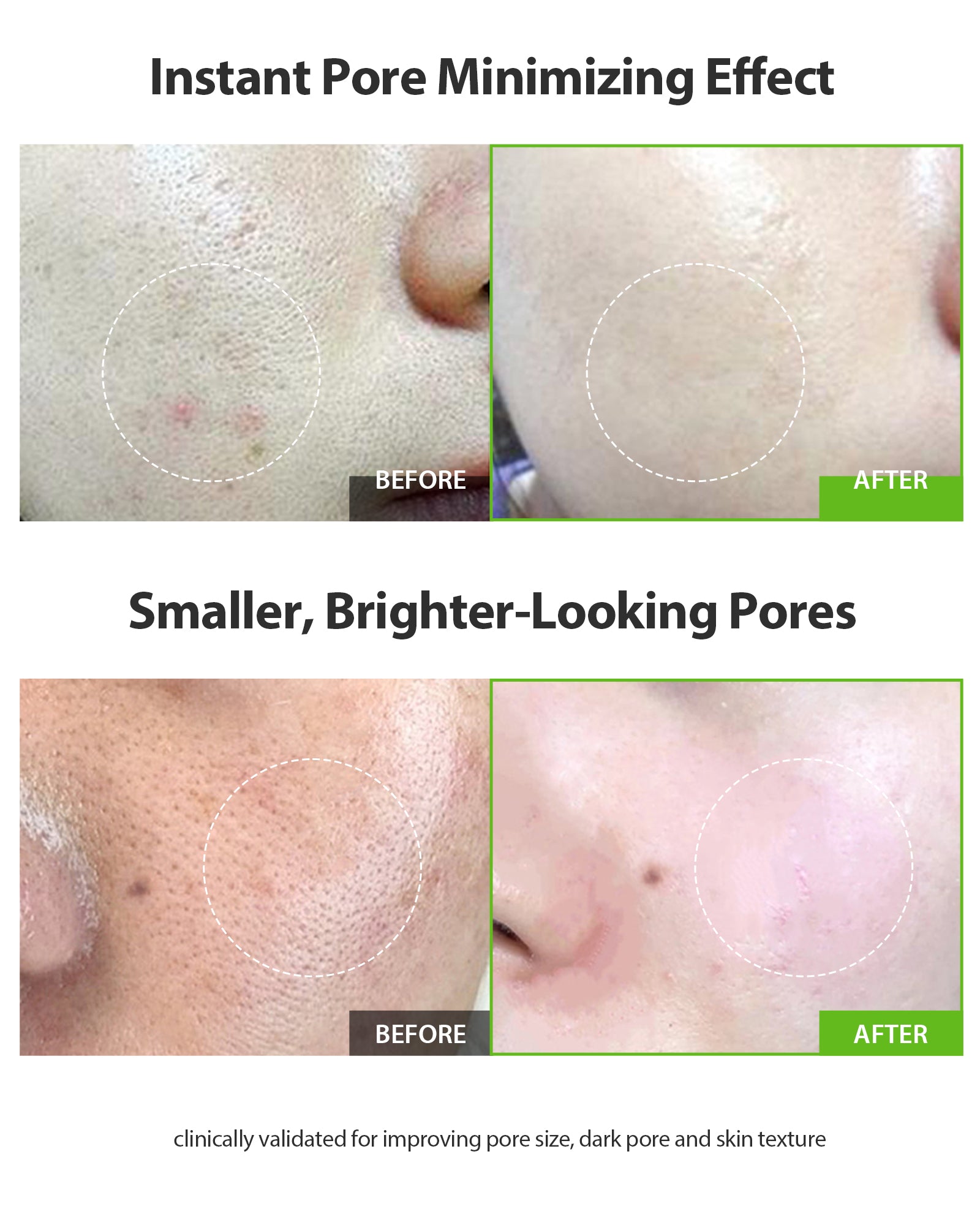 Green Tomato Pore Lifting Ampoule+