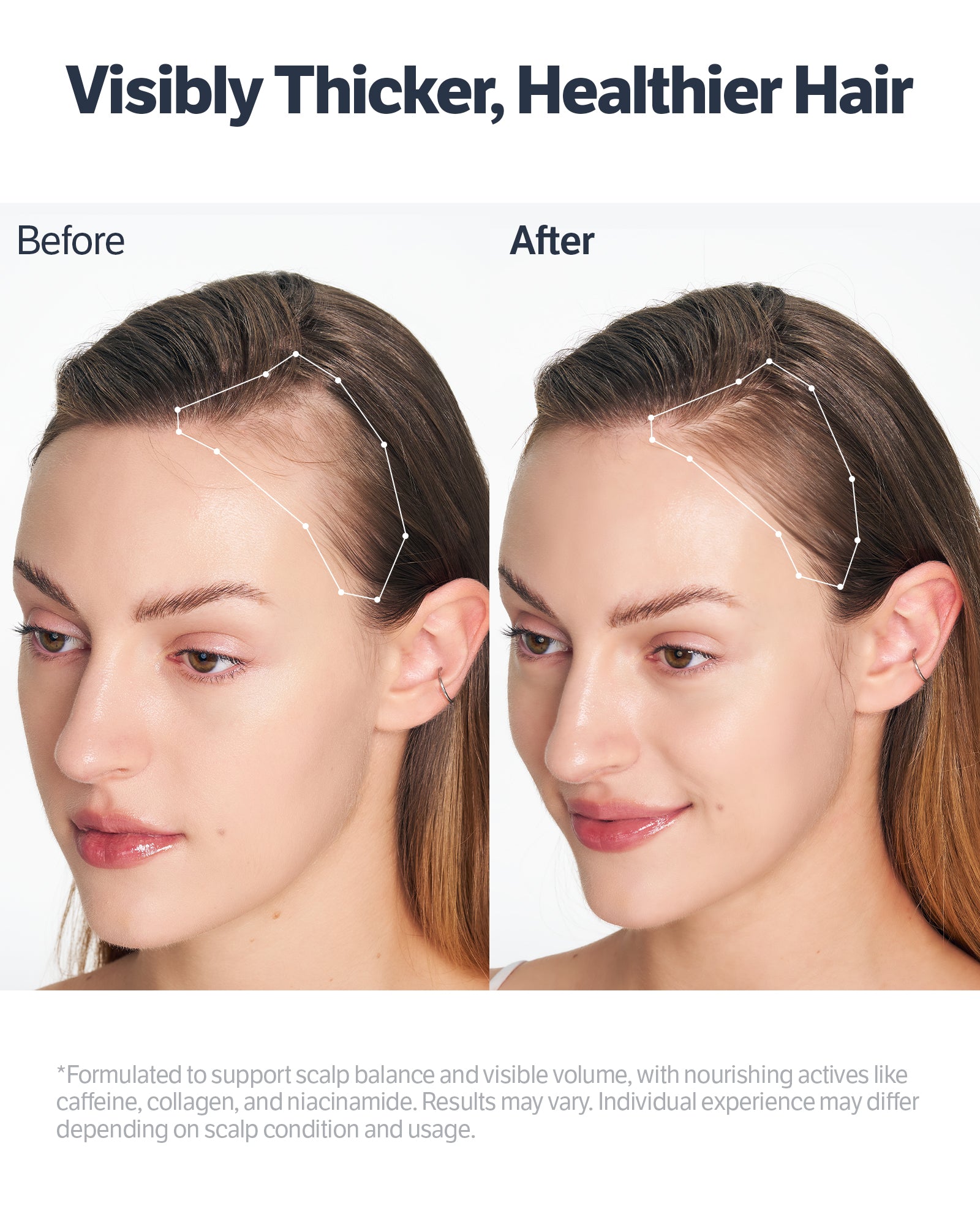 Deep Collagen Retinol Advanced Scalp Treatment Serum