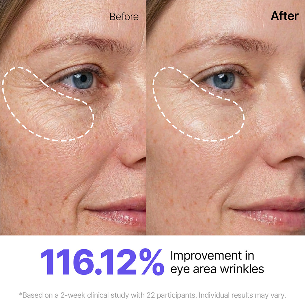 Peptide Lifting & Firming 5-Step Routine
