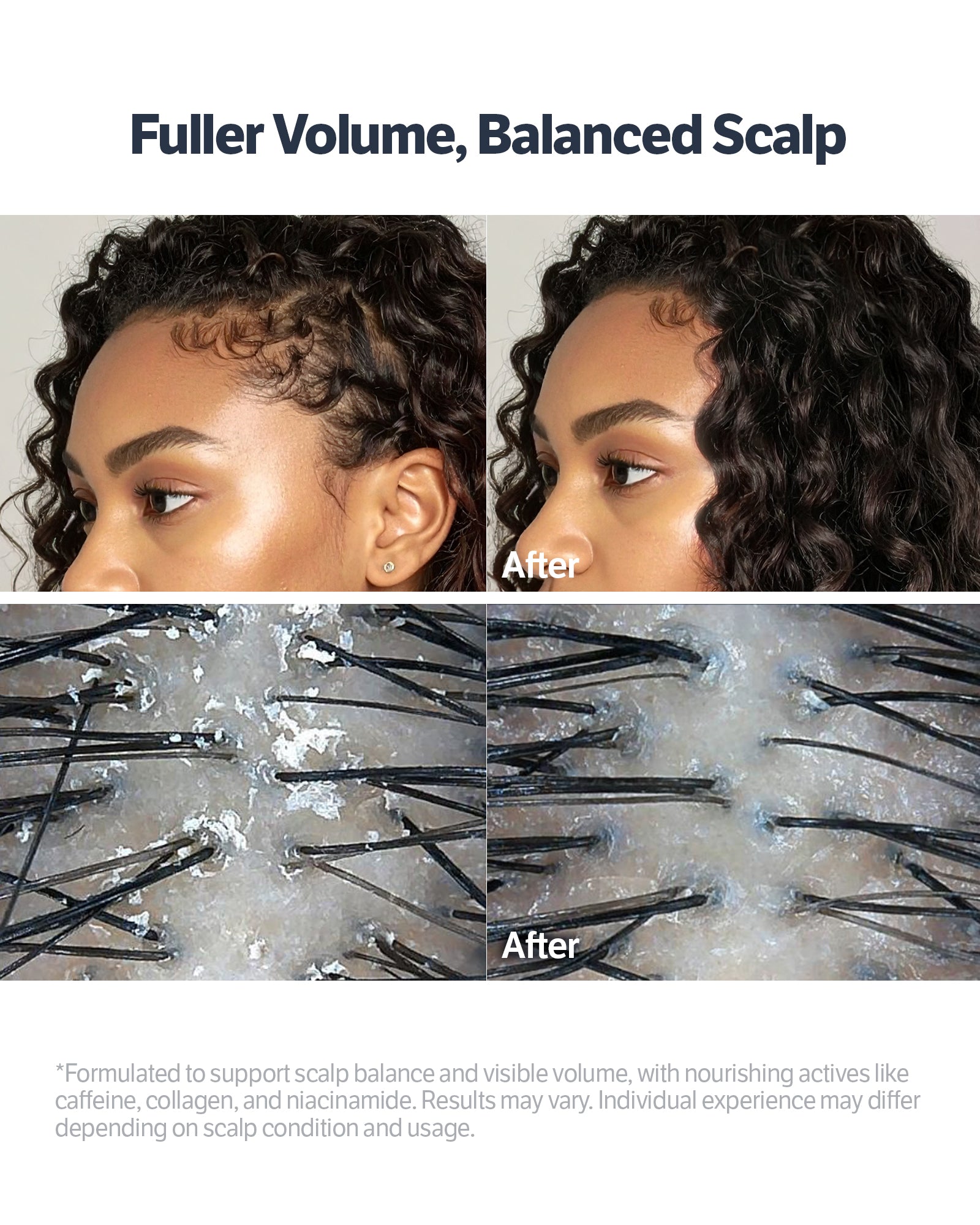 Deep Collagen Retinol Advanced Scalp Treatment Serum