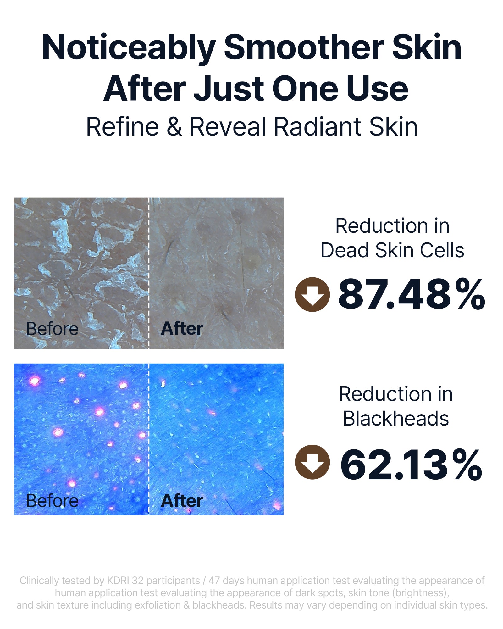 Kojic Acid Niacinamide Rice Peel Shot