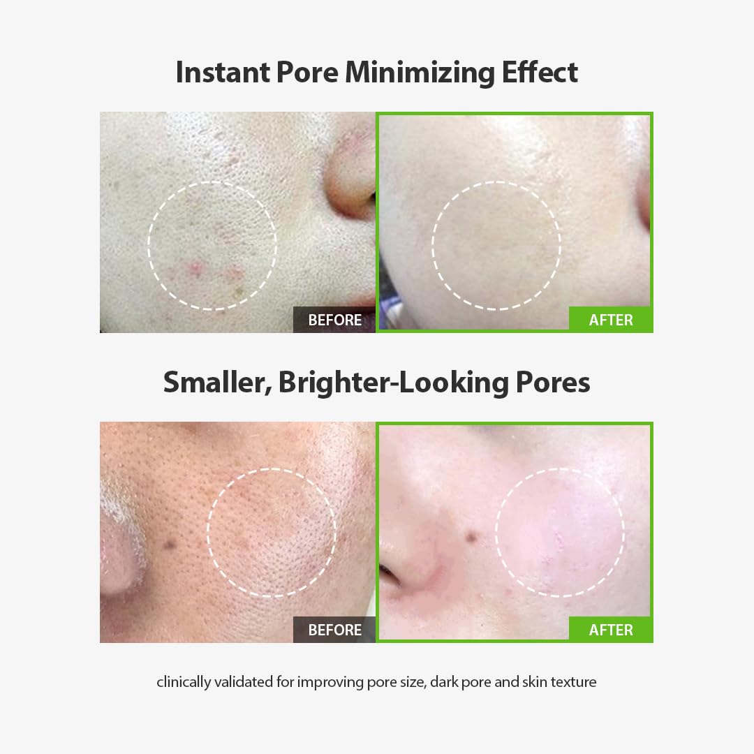 [Free Gift] Green Tomato Pore Lifting Ampoule+