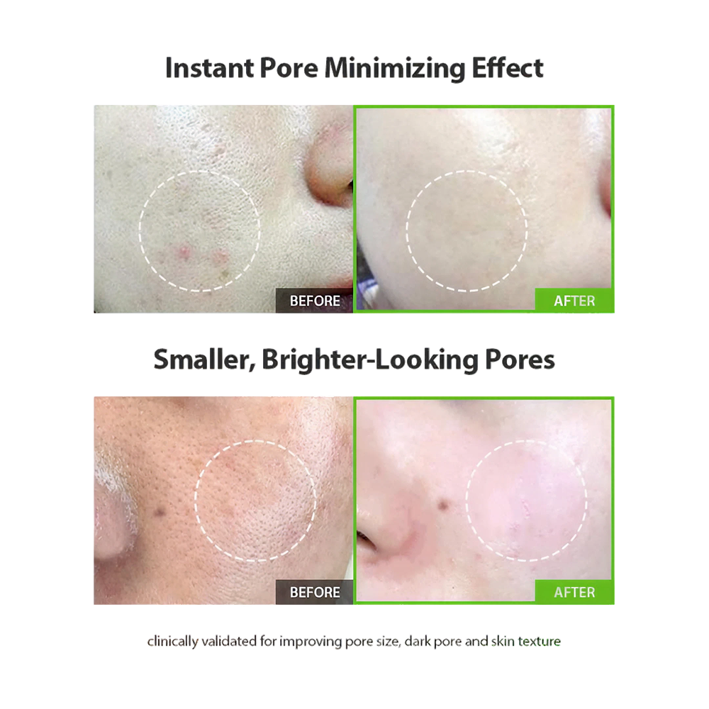 Green Tomato Pore Lifting Ampoule+