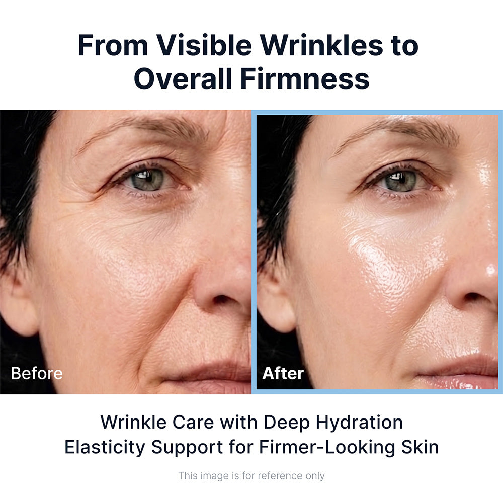 Face-Lift Duo