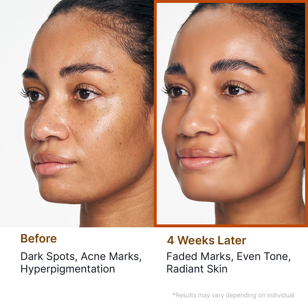 Kojic Acid Niacinamide Brightening Face Gel Cleanser
