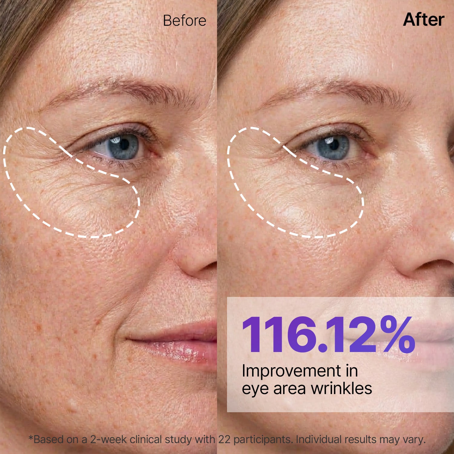 Silk Peptide EGF Intensive Gold Mask