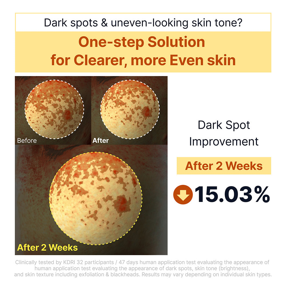 Kojic Acid Niacinamide Rice Peel Shot